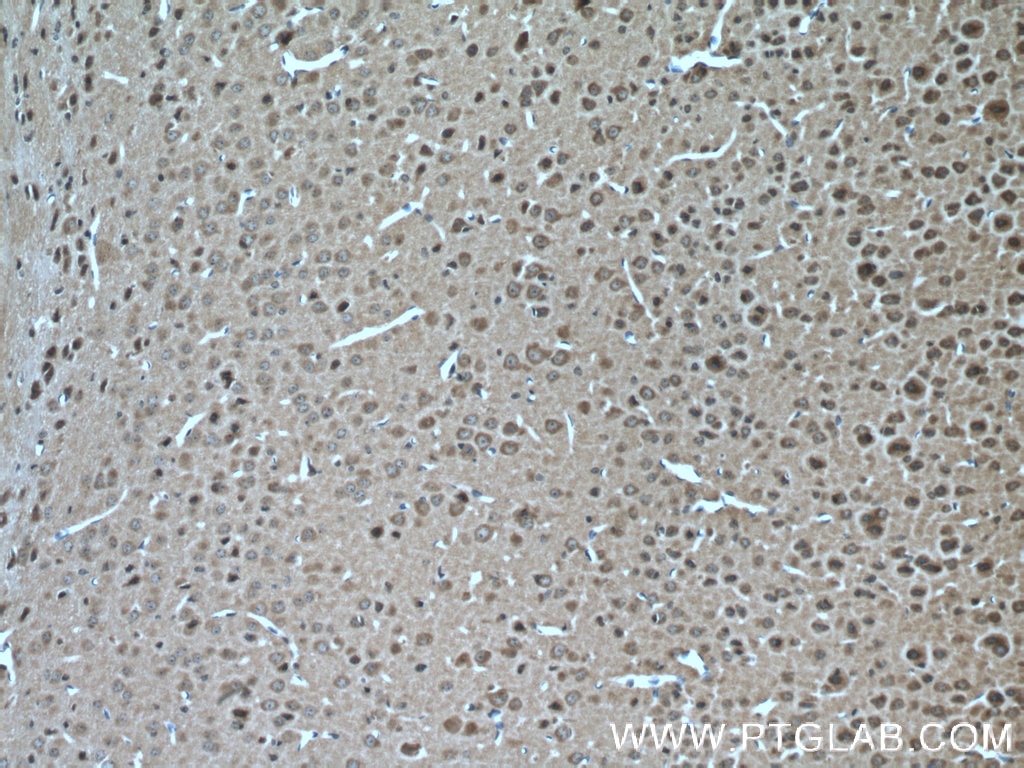 Immunohistochemistry (IHC) staining of mouse brain tissue using KIF17 Polyclonal antibody (14615-1-AP)