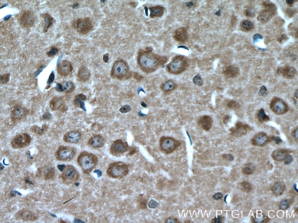 IHC staining of mouse brain using 14615-1-AP