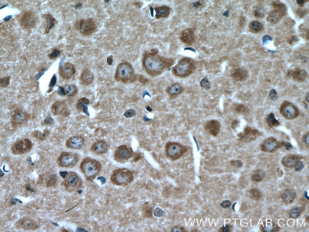 Immunohistochemistry (IHC) staining of mouse brain tissue using KIF17 Polyclonal antibody (14615-1-AP)