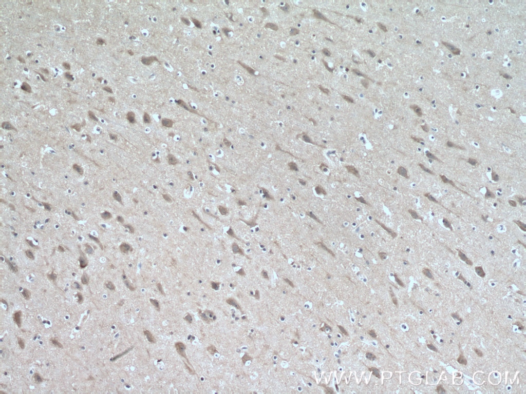 Immunohistochemistry (IHC) staining of human brain tissue using KIF17 Polyclonal antibody (14615-1-AP)