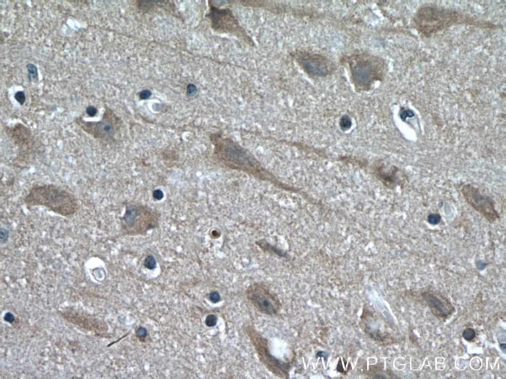 Immunohistochemistry (IHC) staining of human brain tissue using KIF17 Polyclonal antibody (14615-1-AP)