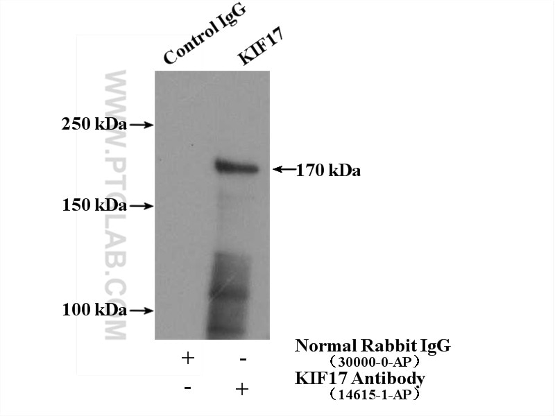 Immunoprecipitation (IP) experiment of mouse brain tissue using KIF17 Polyclonal antibody (14615-1-AP)