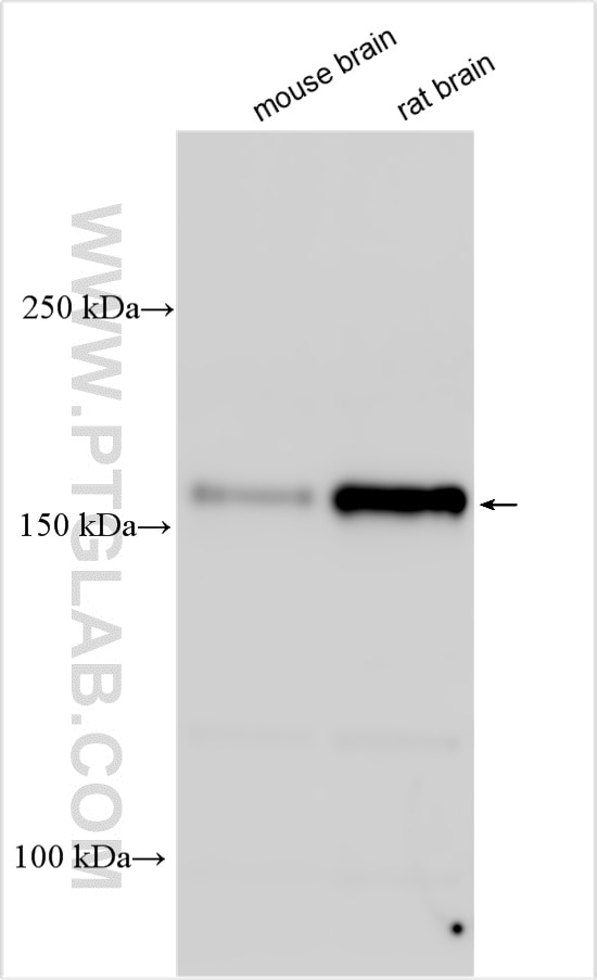 Western Blot (WB) analysis of various lysates using KIF17 Polyclonal antibody (14615-1-AP)
