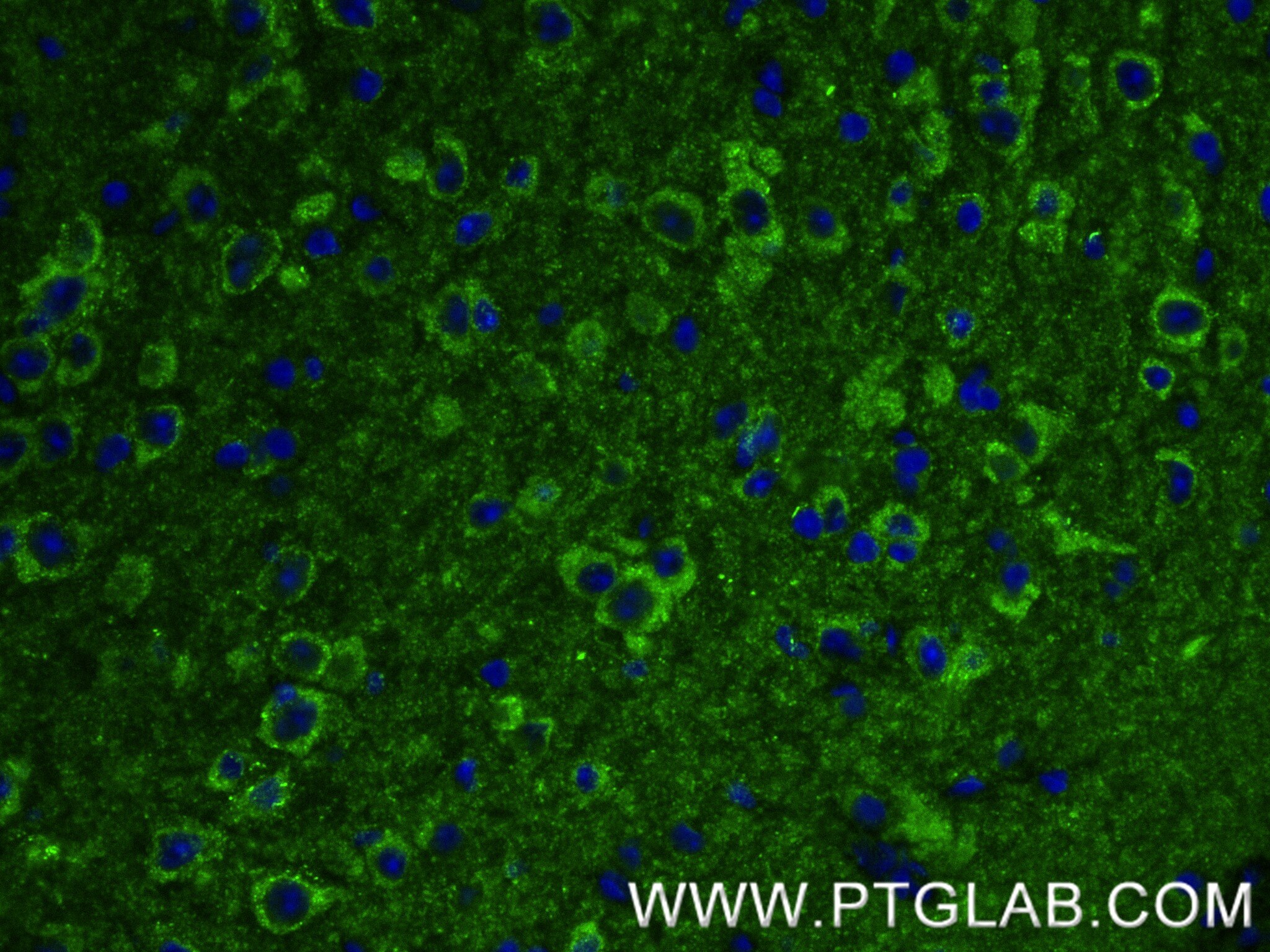 Immunofluorescence (IF) / fluorescent staining of mouse brain tissue using KIF17 Recombinant antibody (85046-1-RR)