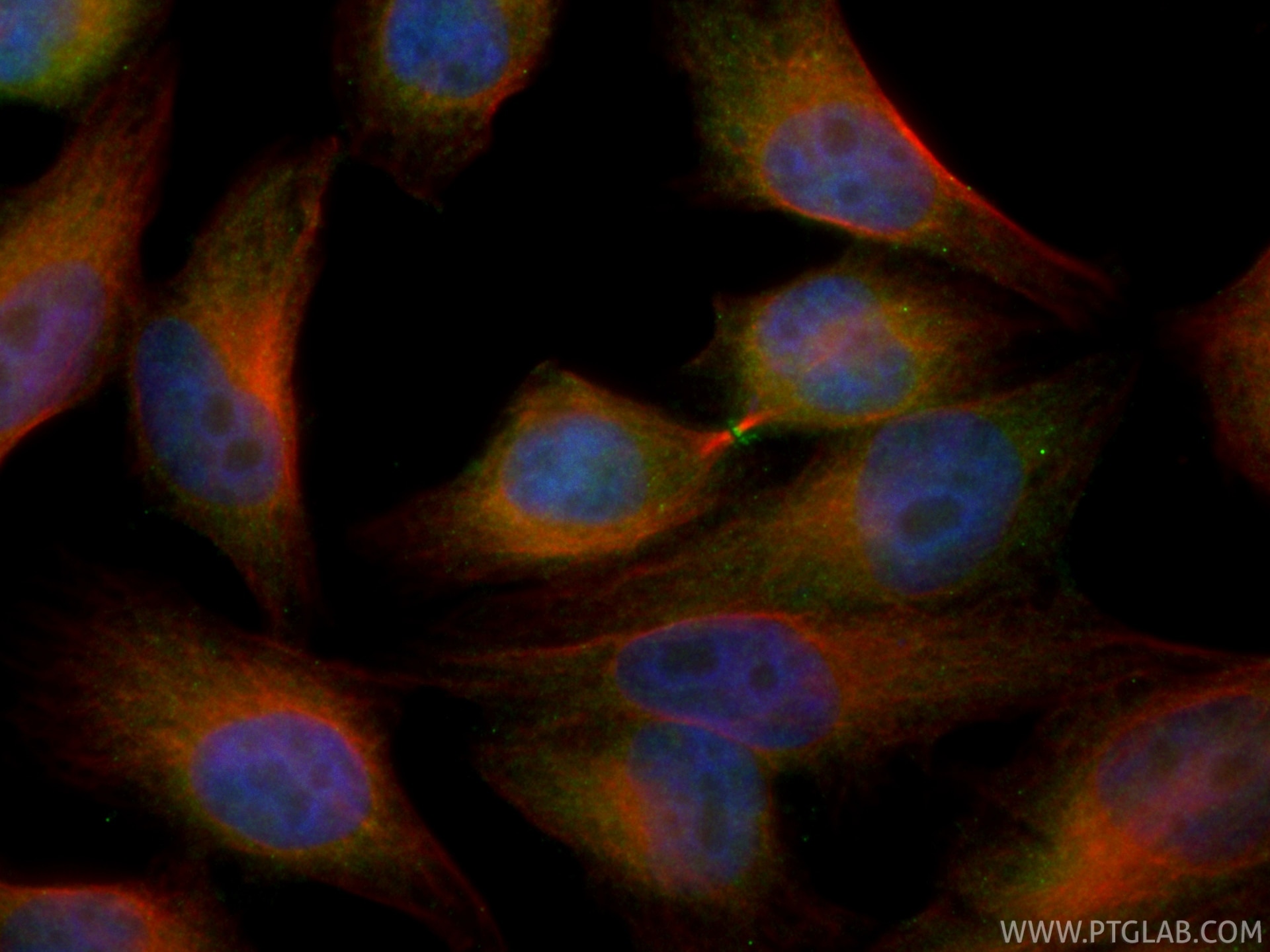 Immunofluorescence (IF) / fluorescent staining of HepG2 cells using CoraLite® Plus 488-conjugated KIF17 Recombinant mo (CL488-85046)