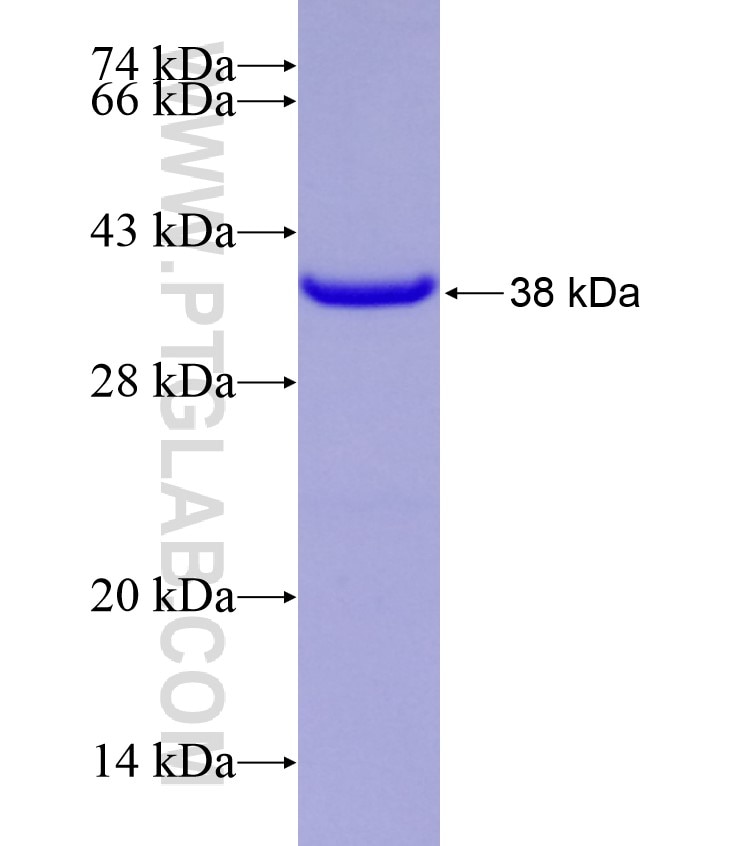 KIF17 fusion protein Ag28839 SDS-PAGE