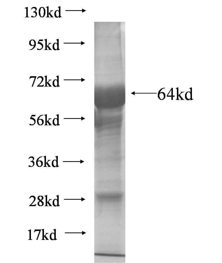 KIF17 fusion protein Ag6217 SDS-PAGE