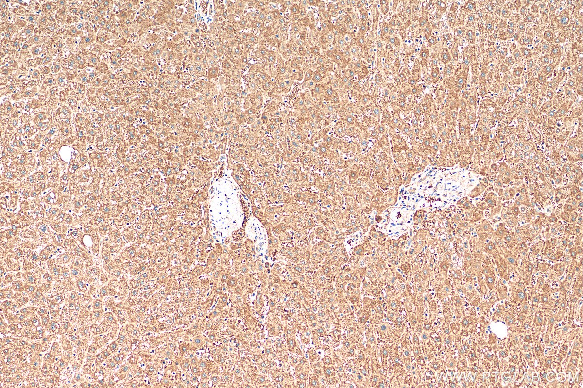 Immunohistochemistry (IHC) staining of human liver tissue using KIF18A Polyclonal antibody (19245-1-AP)