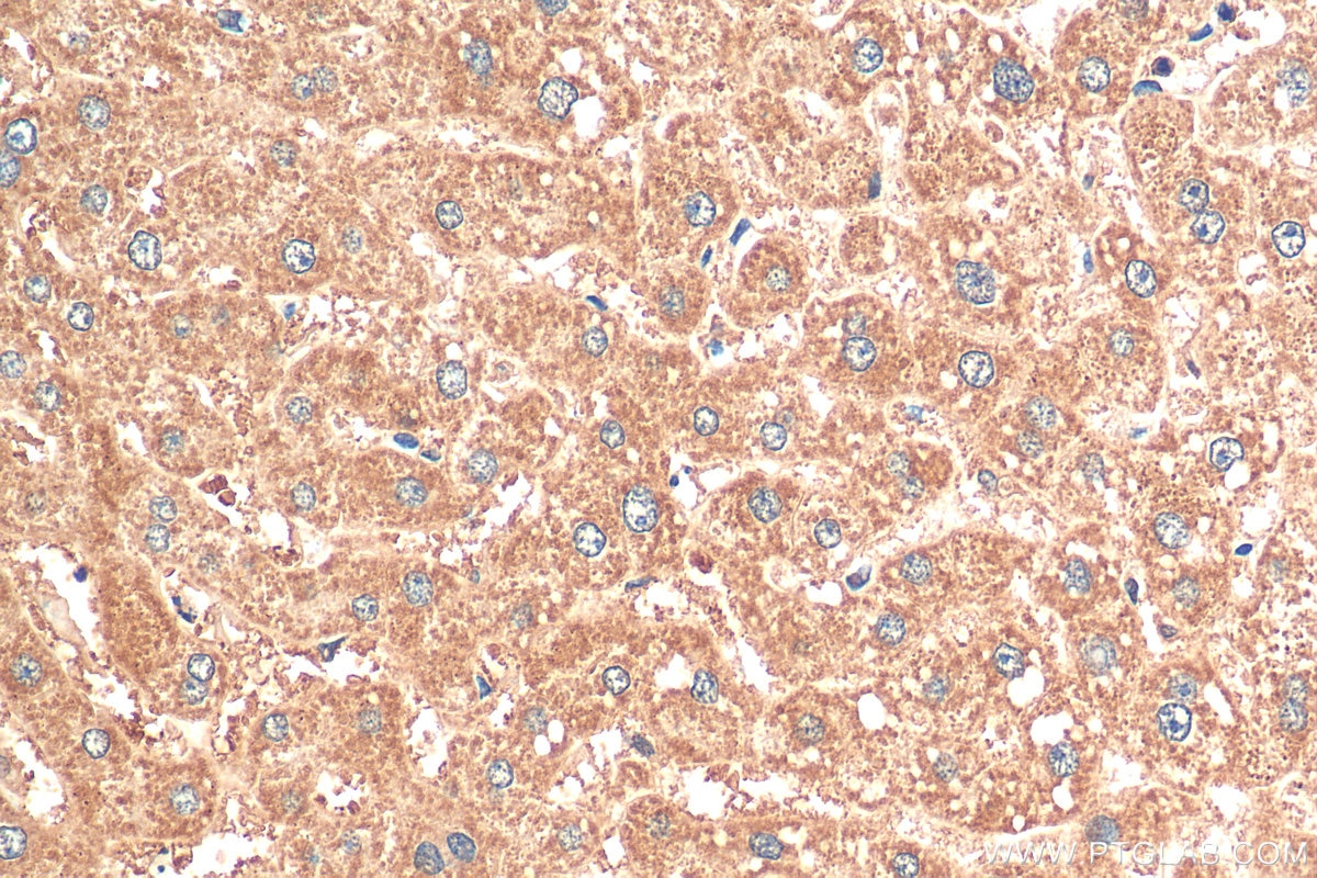 Immunohistochemistry (IHC) staining of human liver tissue using KIF18A Polyclonal antibody (19245-1-AP)