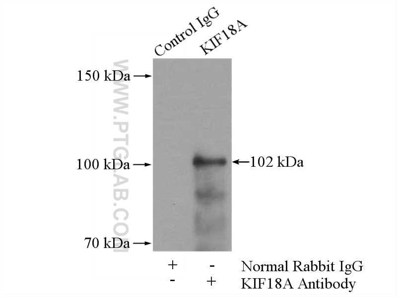 Immunoprecipitation (IP) experiment of Jurkat cells using KIF18A Polyclonal antibody (19245-1-AP)
