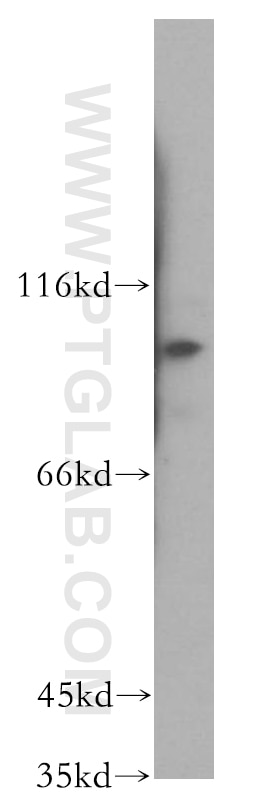 Western Blot (WB) analysis of Jurkat cells using KIF18A Polyclonal antibody (19245-1-AP)