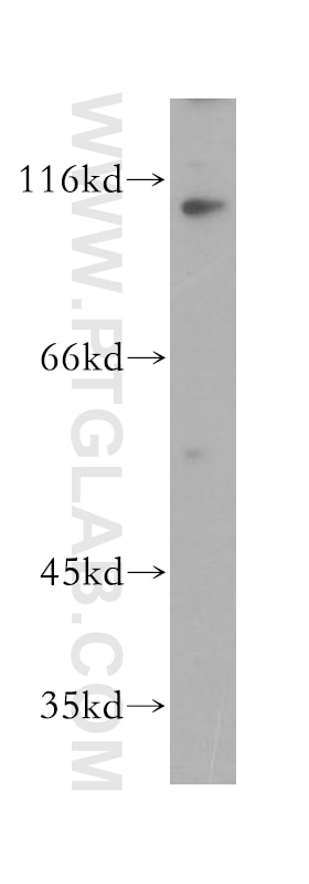 Western Blot (WB) analysis of HeLa cells using KIF18A Polyclonal antibody (19245-1-AP)