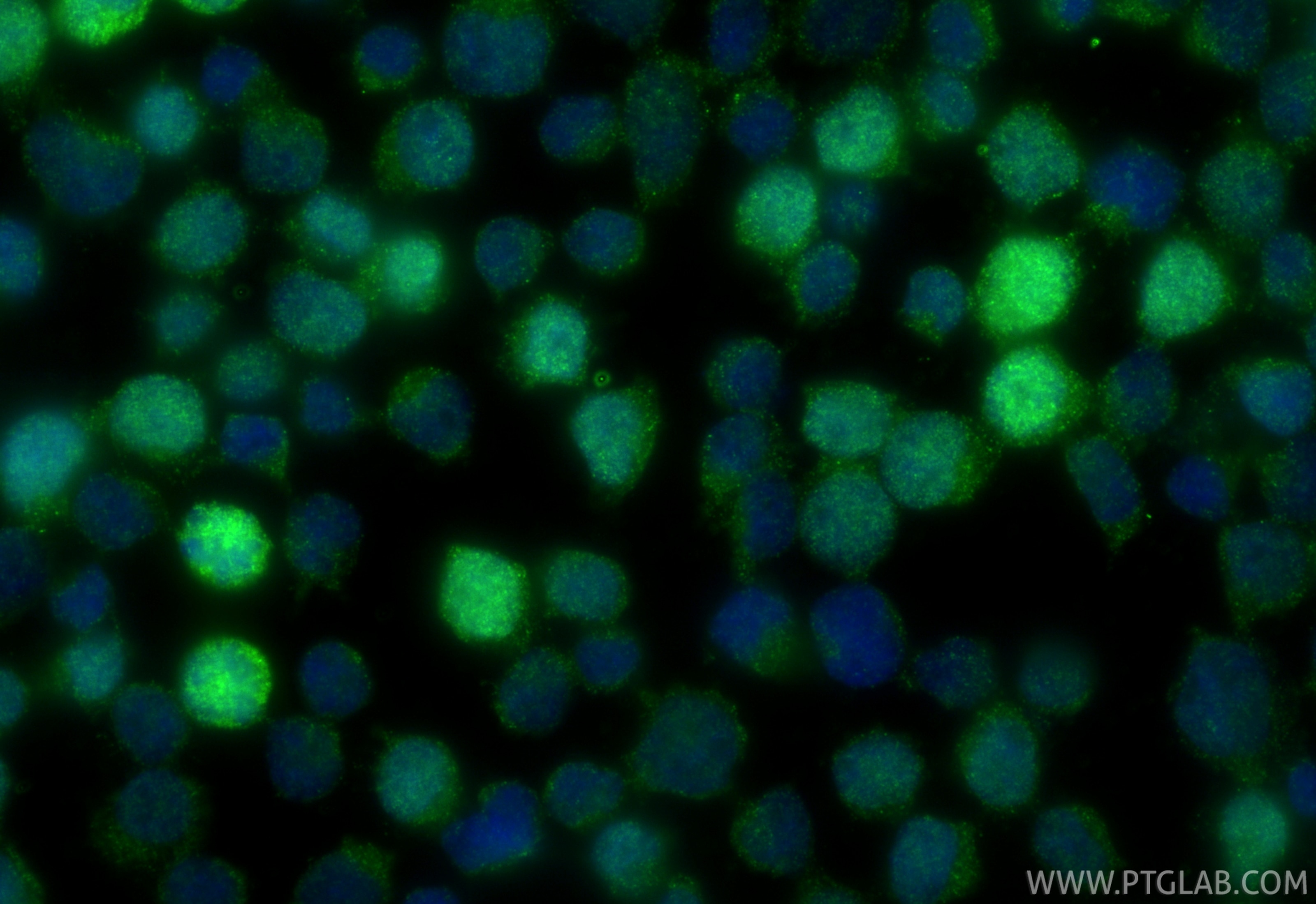 IF Staining of Jurkat using 33139-1-AP Immunofluorescence (IF) / fluorescent staining of Jurkat cells using KIF18B Polyclonal antibody (33139-1-AP)