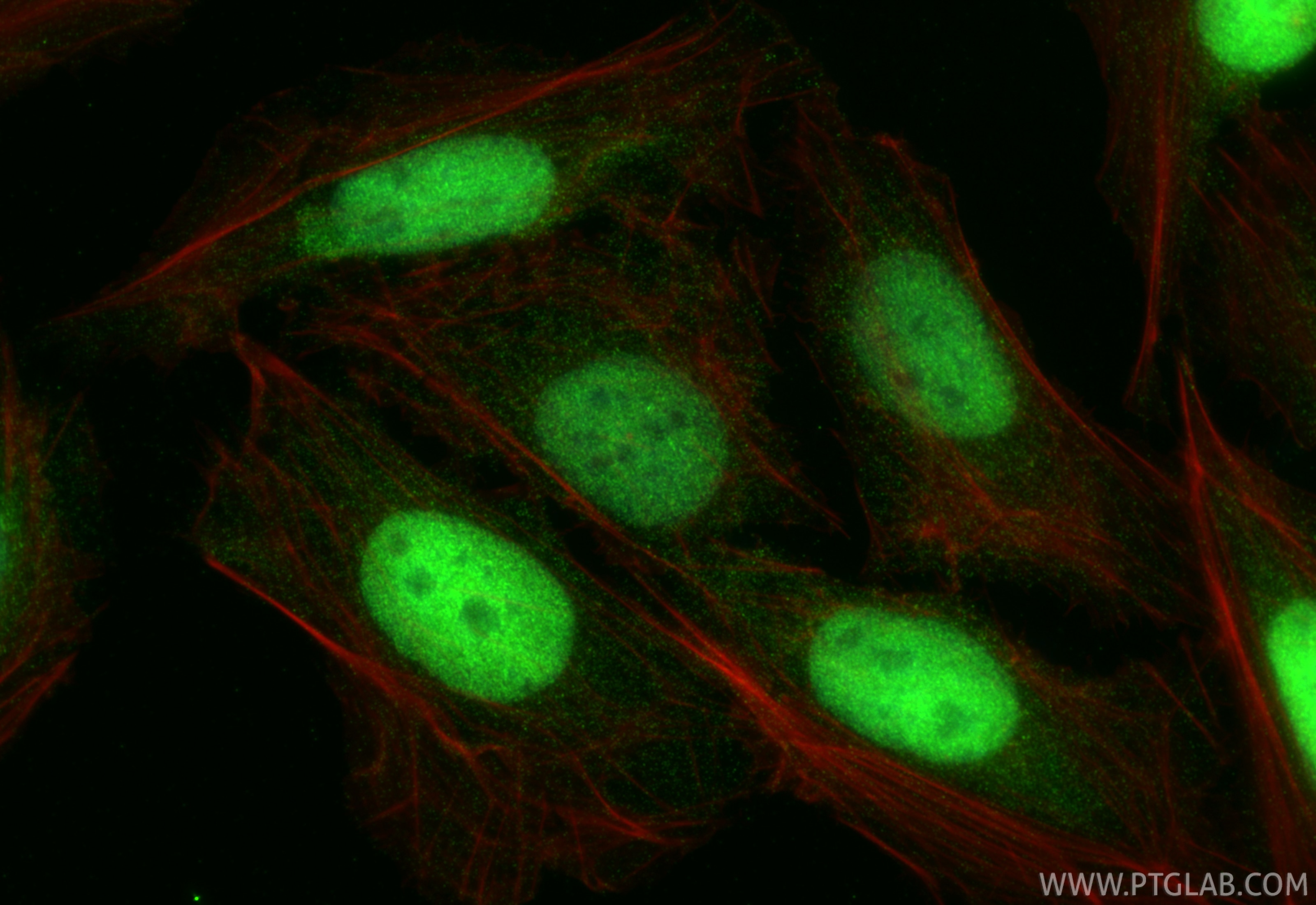 IF Staining of U2OS using 33139-1-AP Immunofluorescence (IF) / fluorescent staining of U2OS cells using KIF18B Polyclonal antibody (33139-1-AP)