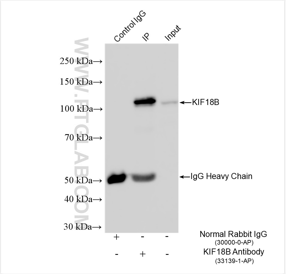 IP experiment of Jurkat using 33139-1-AP Immunoprecipitation (IP) experiment of Jurkat cells using KIF18B Polyclonal antibody (33139-1-AP)