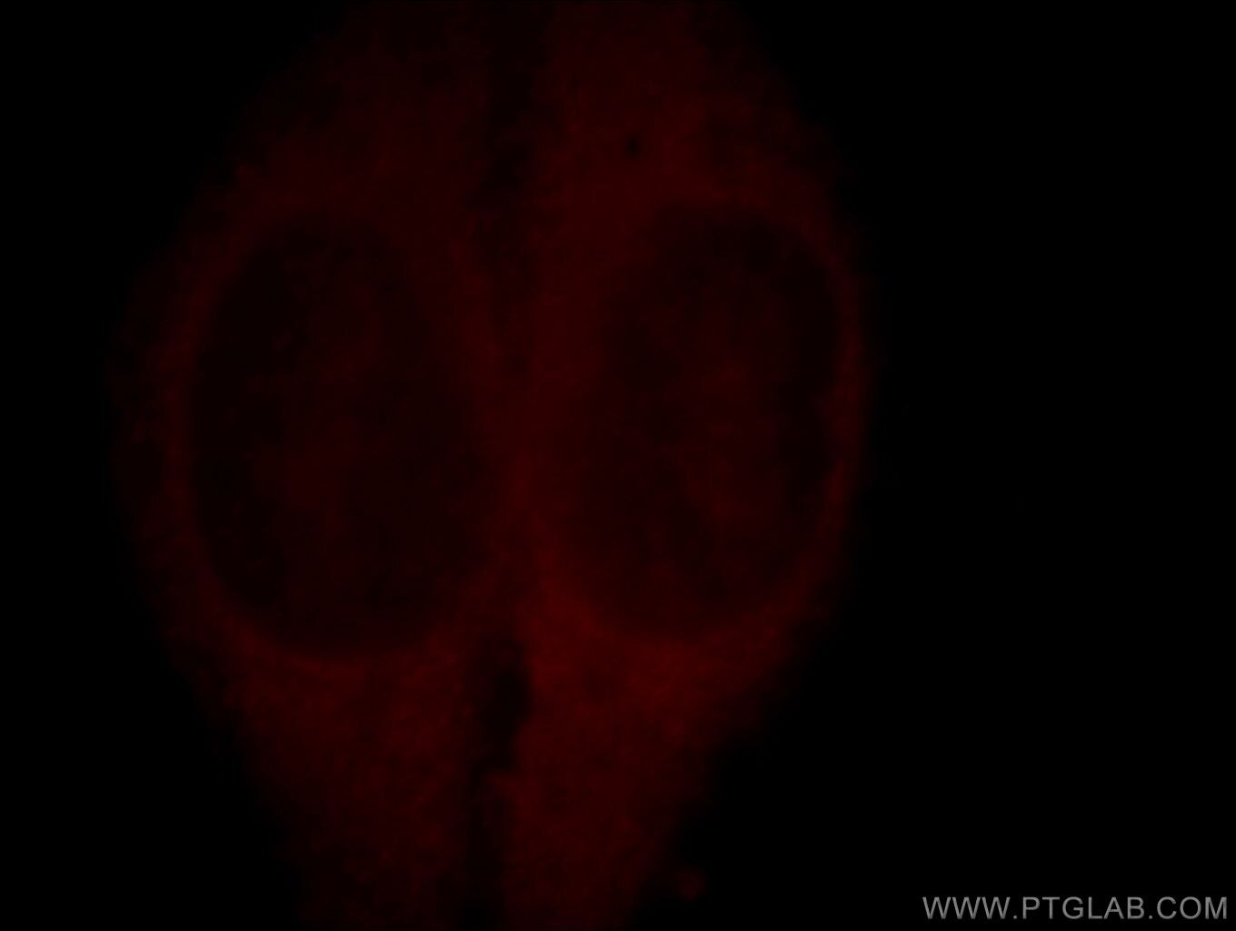 Immunofluorescence (IF) / fluorescent staining of HepG2 cells using KIF19 Polyclonal antibody (19551-1-AP)