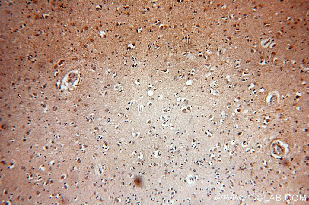 Immunohistochemistry (IHC) staining of human brain tissue using KIF19 Polyclonal antibody (19551-1-AP)