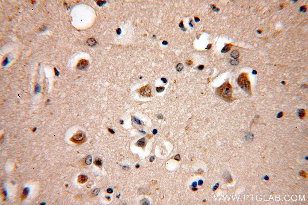 Immunohistochemistry (IHC) staining of human brain tissue using KIF19 Polyclonal antibody (19551-1-AP)