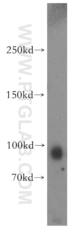 Western Blot (WB) analysis of human brain tissue using KIF19 Polyclonal antibody (19551-1-AP)