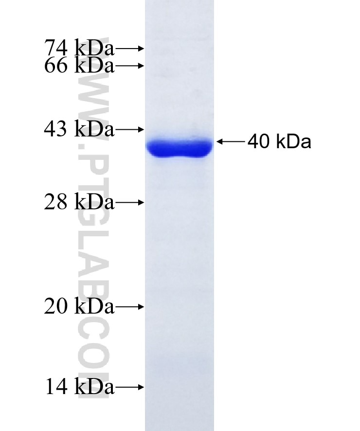 KIF19 fusion protein Ag10922 SDS-PAGE
