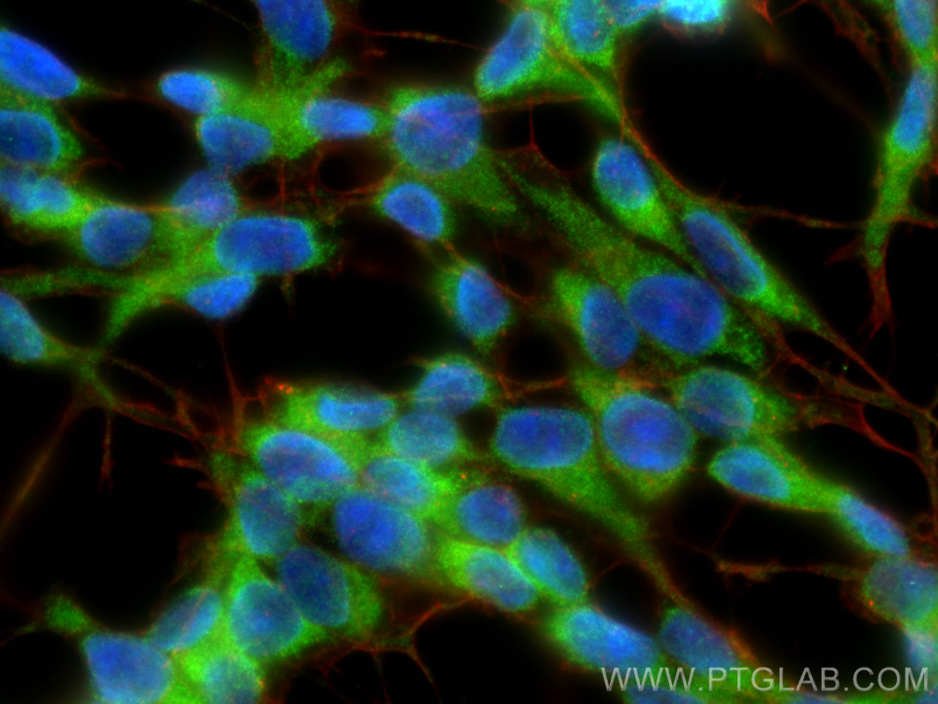 Immunofluorescence (IF) / fluorescent staining of SH-SY5Y cells using KIF1A Polyclonal antibody (24841-1-AP)