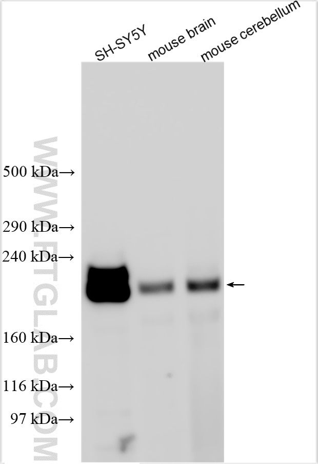 Western Blot (WB) analysis of various lysates using KIF1A Polyclonal antibody (24841-1-AP)