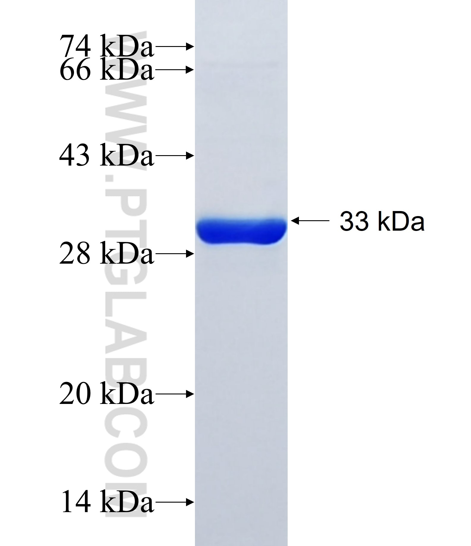 KIF1A fusion protein Ag18817 SDS-PAGE