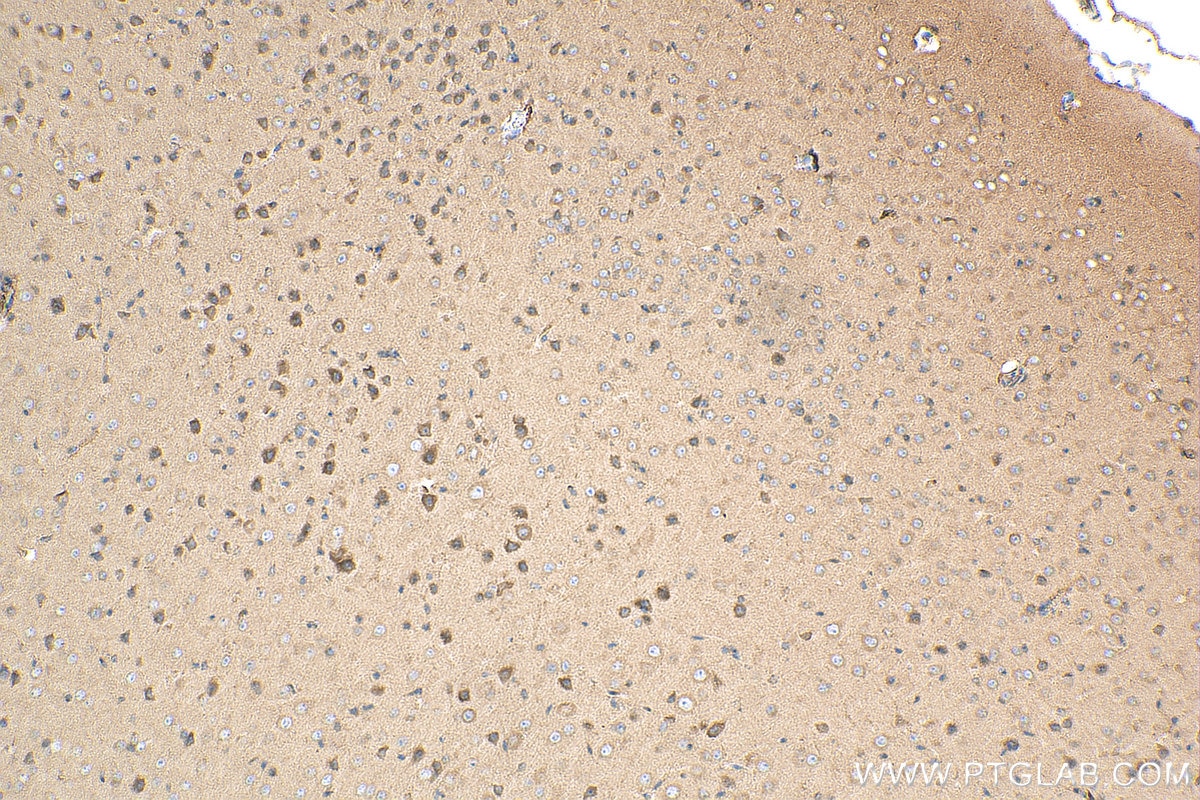 Immunohistochemistry (IHC) staining of mouse brain tissue using KIF1B Polyclonal antibody (15263-1-AP)