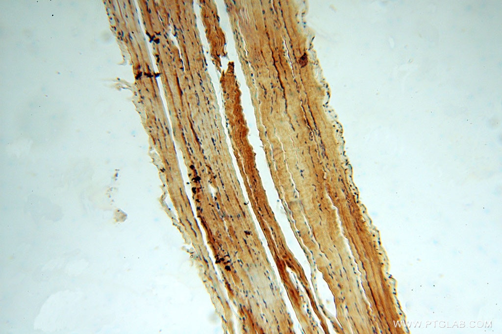 IHC staining of human skeletal muscle using 15263-1-AP
