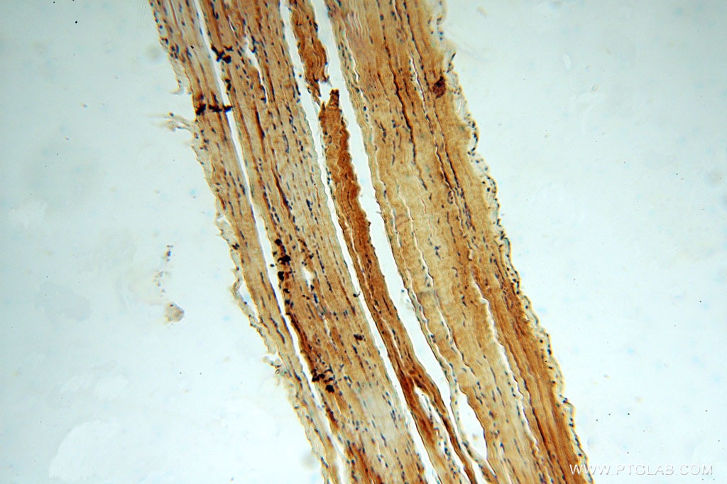 Immunohistochemistry (IHC) staining of human skeletal muscle tissue using KIF1B Polyclonal antibody (15263-1-AP)