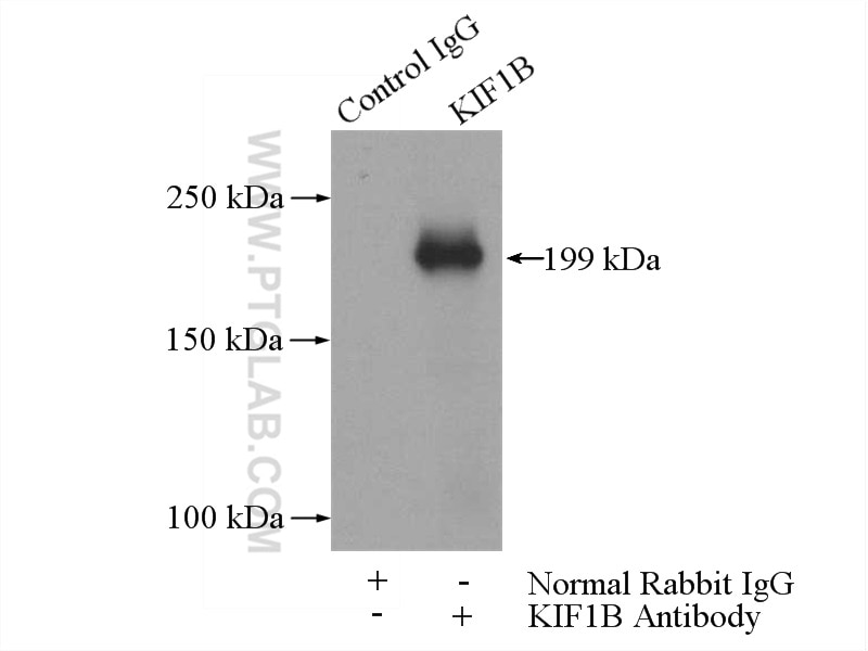 Immunoprecipitation (IP) experiment of HeLa cells using KIF1B Polyclonal antibody (15263-1-AP)