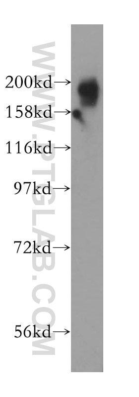 Western Blot (WB) analysis of HeLa cells using KIF1B Polyclonal antibody (15263-1-AP)