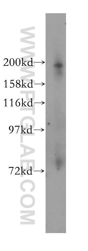 Western Blot (WB) analysis of HEK-293 cells using KIF1B Polyclonal antibody (15263-1-AP)