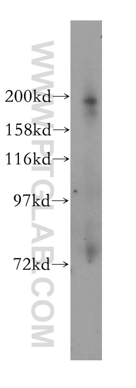 Western Blot (WB) analysis of HEK-293 cells using KIF1B Polyclonal antibody (15263-1-AP)