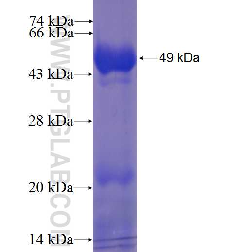 KIF1B fusion protein Ag7263 SDS-PAGE