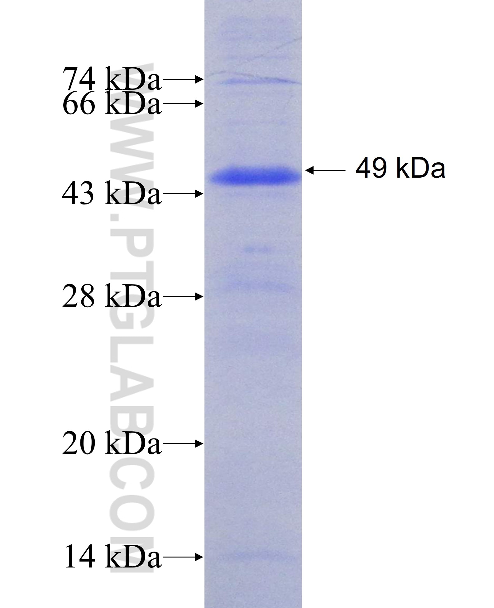 KIF1B fusion protein Ag7263 SDS-PAGE