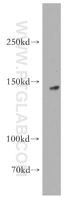 Western Blot (WB) analysis of mouse heart tissue using KIF1C Polyclonal antibody (12760-1-AP)