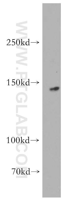 WB analysis of mouse heart using 12760-1-AP