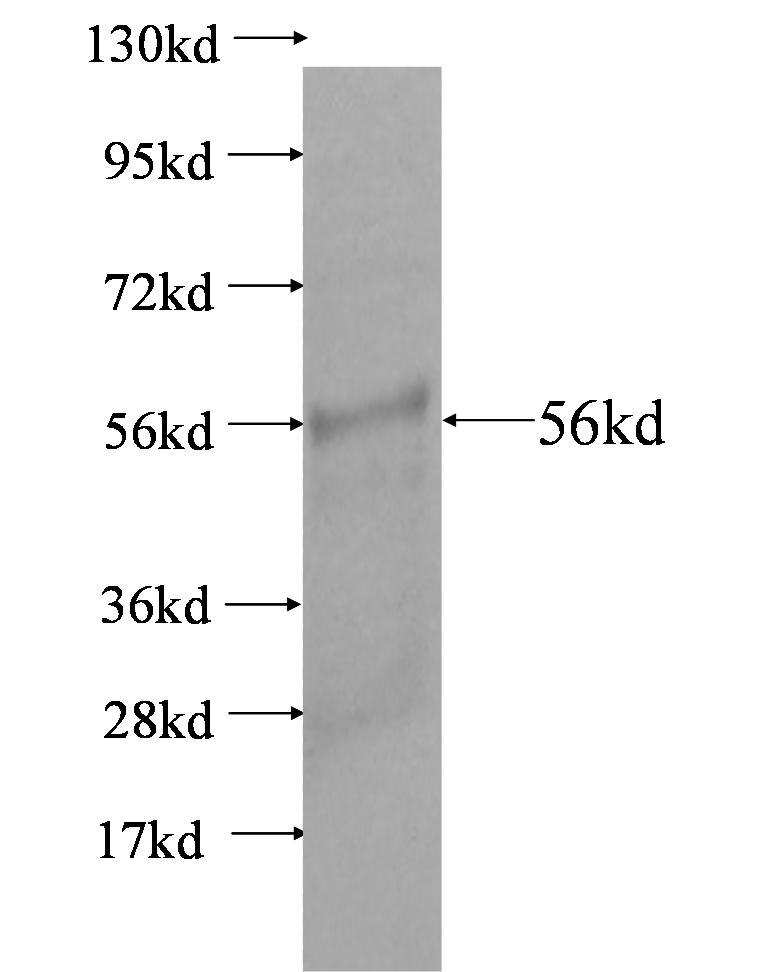 KIF1C fusion protein Ag3500 SDS-PAGE