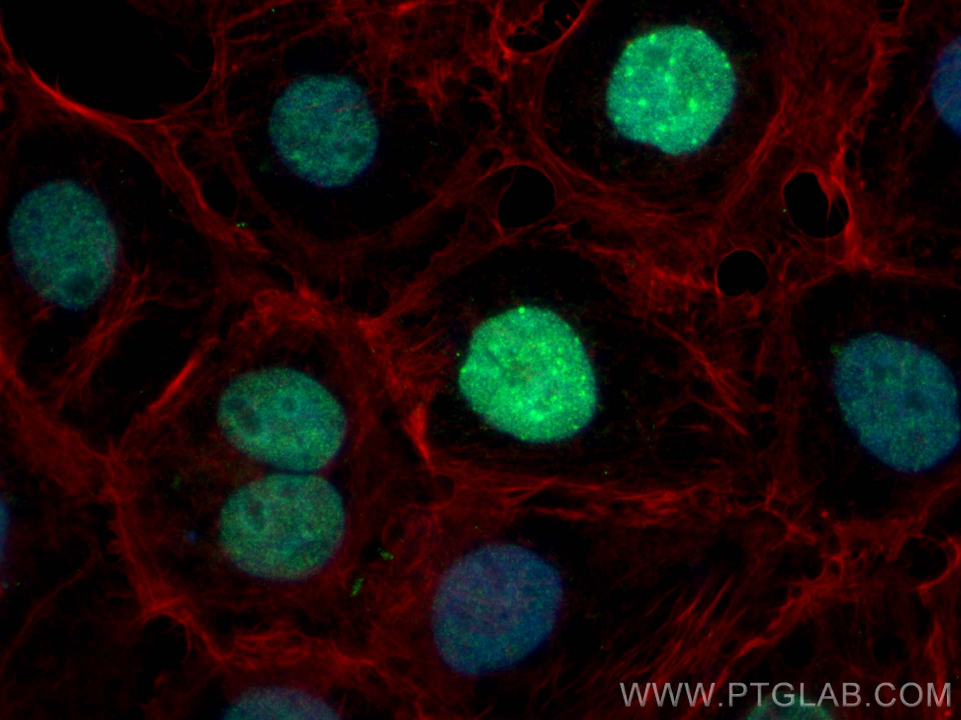 Immunofluorescence (IF) / fluorescent staining of A431 cells using KIF20A Polyclonal antibody (15911-1-AP)
