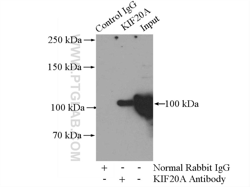 Immunoprecipitation (IP) experiment of HEK-293 cells using KIF20A Polyclonal antibody (15911-1-AP)
