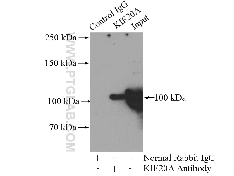 IP experiment of HEK-293 using 15911-1-AP