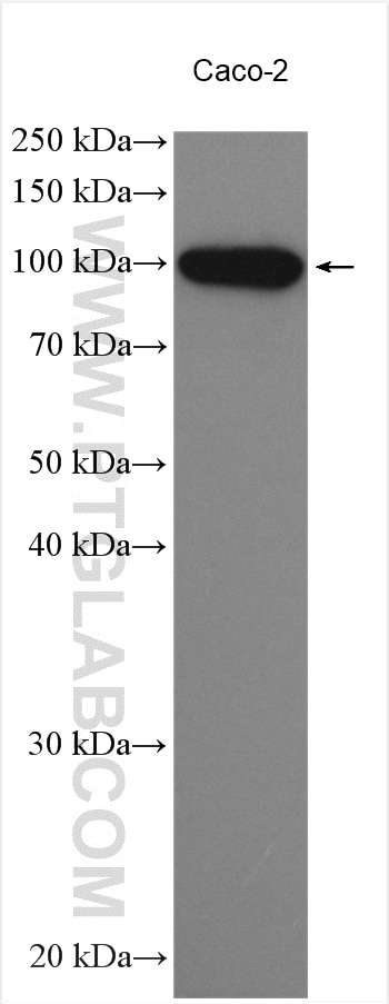 Western Blot (WB) analysis of various lysates using KIF20A Polyclonal antibody (15911-1-AP)