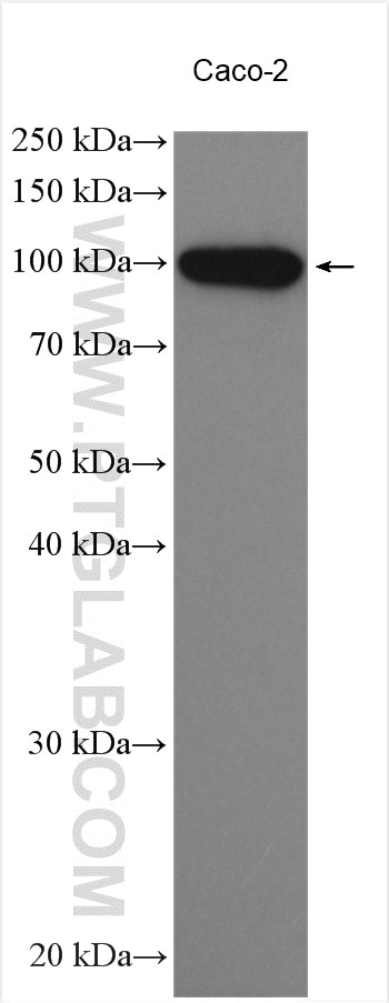 WB analysis using 15911-1-AP