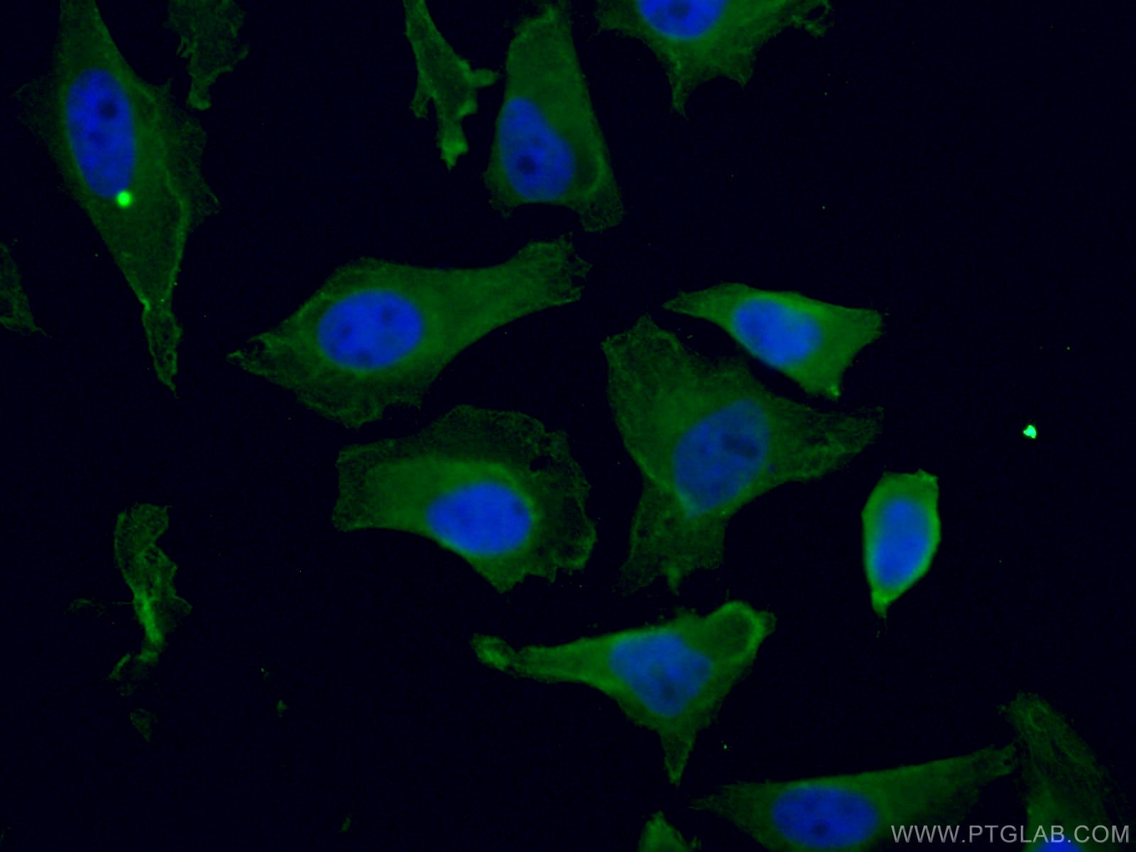 Immunofluorescence (IF) / fluorescent staining of HeLa cells using KIF20A Monoclonal antibody (67190-1-Ig)