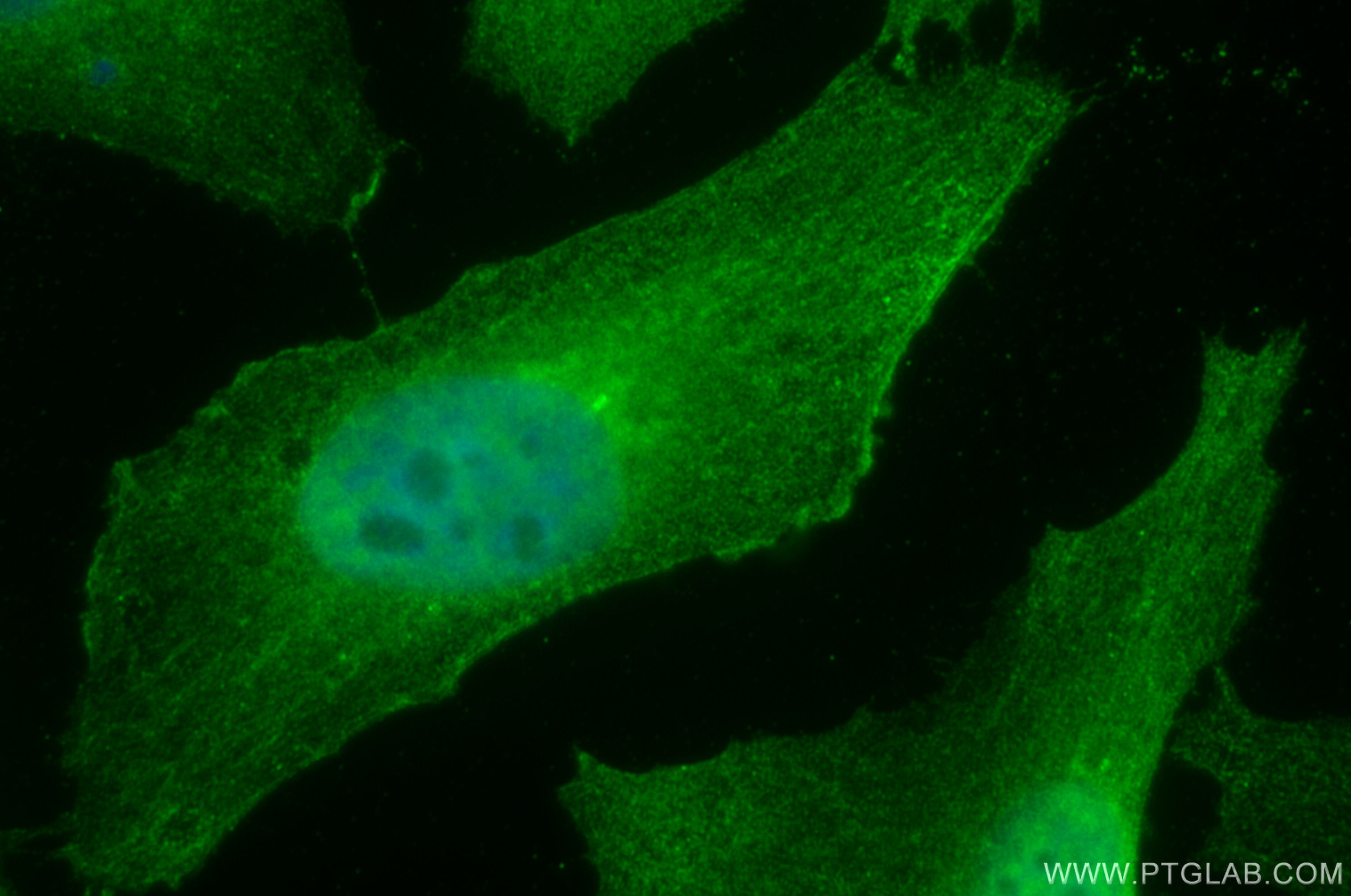 Immunofluorescence (IF) / fluorescent staining of HeLa cells using KIF20A Monoclonal antibody (67190-1-Ig)