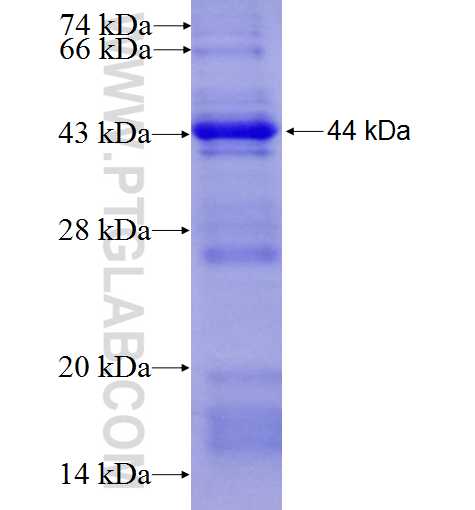KIF20A fusion protein Ag8916 SDS-PAGE