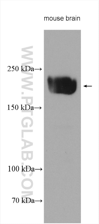 Western Blot (WB) analysis of various lysates using KIF20B Polyclonal antibody (27269-1-AP)