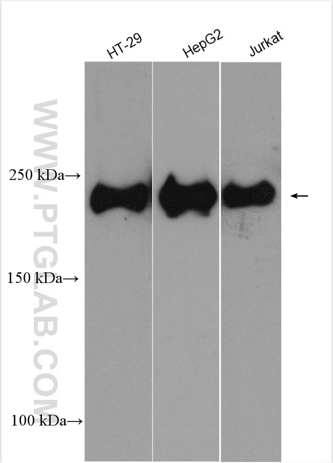 Western Blot (WB) analysis of various lysates using KIF20B Polyclonal antibody (27269-1-AP)