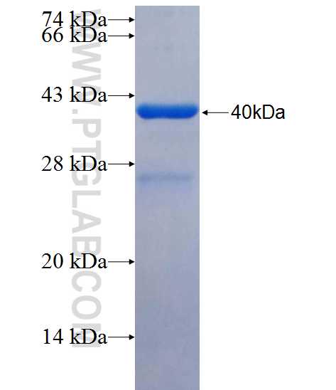 KIF20B fusion protein Ag26191 SDS-PAGE